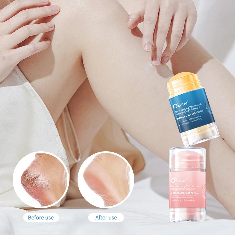 Heels - Krim Kaki Anti Retak Untuk Kaki